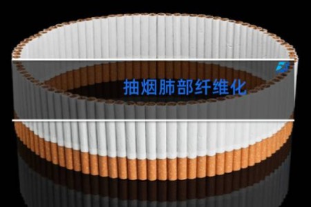 抽烟肺部纤维化 - 吸烟的人一般都有肺纤维化