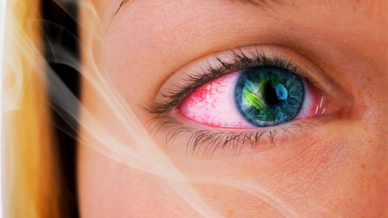 吸烟会导致视力下降，以下是保护眼睛的健康提示